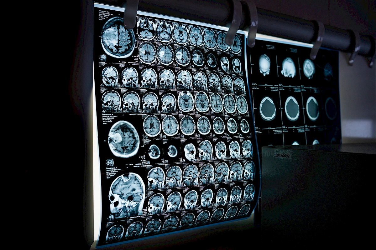 X-ray MRI scan
